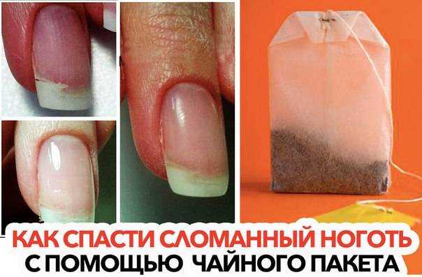 Что делать если сломался ноготь: сбоку, посередине или у основания; как отремонтировать