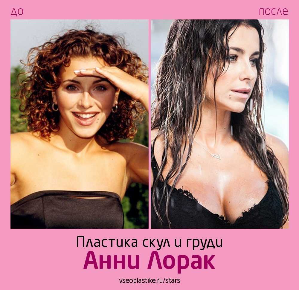 Ани лорак: биография, фото, интересные факты и личная жизнь