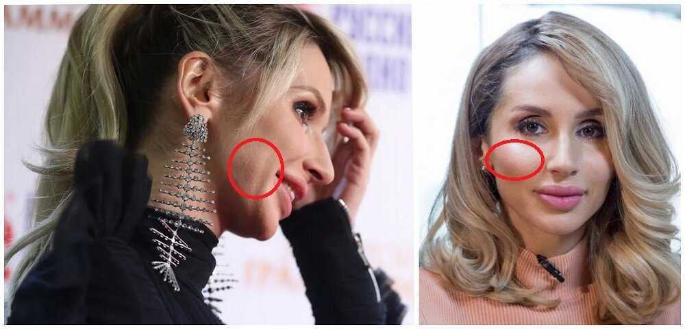 Светлана лобода: фото до пластики и после