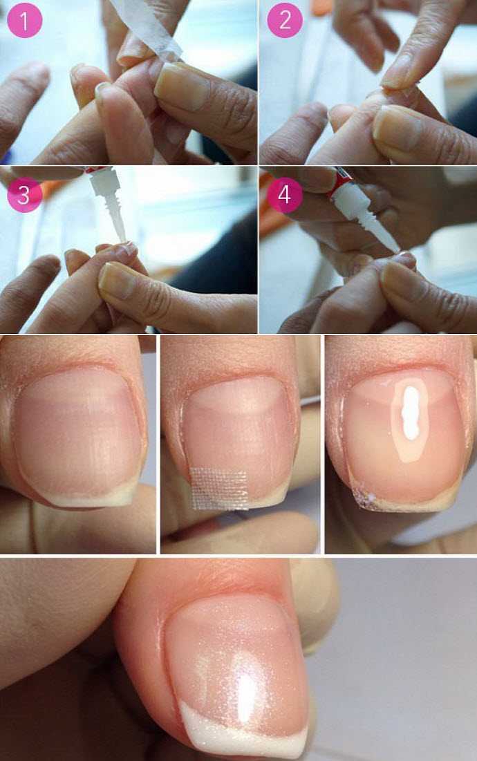 Что можно сделать при сломанном под корень ногте - салон красоты sos beauty