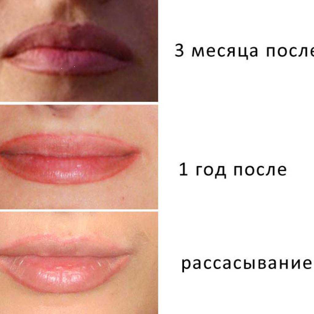 Техники татуажа губ: фото до и после процедуры